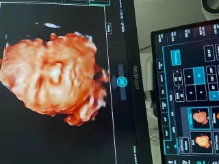 Op. Dr. İpek Demir profilinde yer alan galeri fotoğrafı.