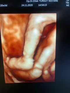 Op. Dr. Dilek Turğut Kestane profilinde yer alan galeri fotoğrafı.