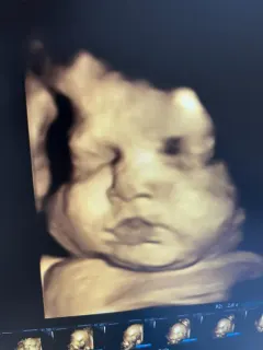 Doç. Dr. Ceren Gölbaşı profilinde yer alan galeri fotoğrafı.