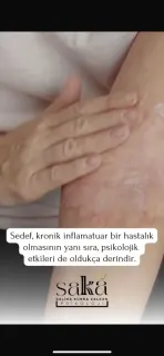 Uzm. Psk. Saliha Kübra Kalkan profilinde yer alan galeri fotoğrafı.