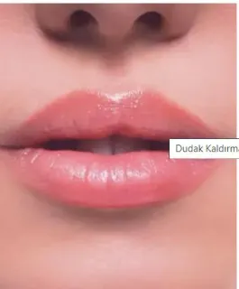 Op. Dr. Nazlı Selvi profilinde yer alan galeri fotoğrafı.