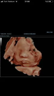 Op. Dr. Feyza Özçelik profilinde yer alan galeri fotoğrafı.