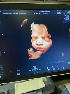 Op. Dr. Emine Suat profilinde yer alan galeri fotoğrafı.