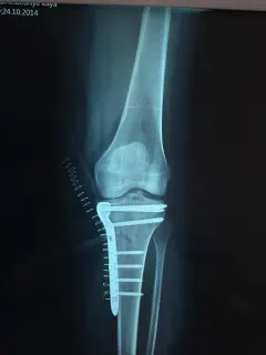 Op. Dr. Mehmet Hakan Yılmaz profilinde yer alan galeri fotoğrafı.