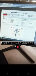 Dyt. Elif Seçgin profilinde yer alan galeri fotoğrafı.