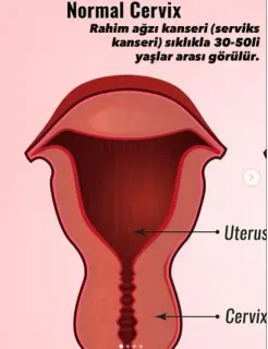Op. Dr. Melike Omak Yıldırım profilinde yer alan galeri fotoğrafı.
