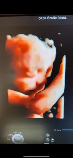 Op. Dr. Özgür Özkul profilinde yer alan galeri fotoğrafı.