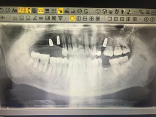 Dt. Fatma Gül Madran profilinde yer alan galeri fotoğrafı.