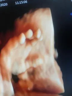Op. Dr. Dilek Turğut Kestane profilinde yer alan galeri fotoğrafı.