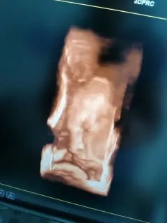 Op. Dr. Talha Ayvaz profilinde yer alan galeri fotoğrafı.