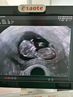 Op. Dr. Talha Ayvaz profilinde yer alan galeri fotoğrafı.