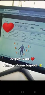 Dyt. Elif Seçgin profilinde yer alan galeri fotoğrafı.