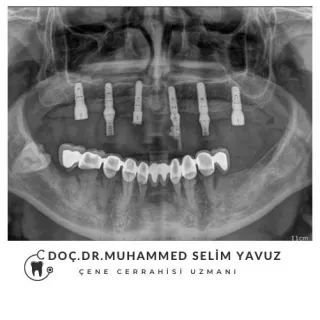 Doç. Dr. Muhammed Selim Yavuz profilinde yer alan galeri fotoğrafı.