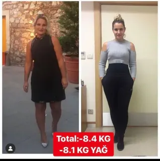 Dyt. Melisa Arzu profilinde yer alan galeri fotoğrafı.