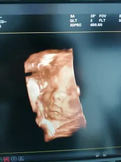 Op. Dr. Talha Ayvaz profilinde yer alan galeri fotoğrafı.