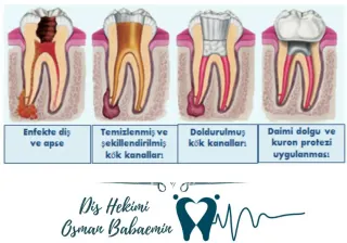 Dt. Osman Babaemin profilinde yer alan galeri fotoğrafı.