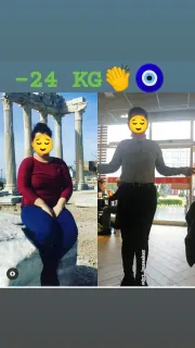 Dyt. Buse Akay Şen profilinde yer alan galeri fotoğrafı.