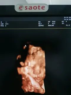 Op. Dr. Talha Ayvaz profilinde yer alan galeri fotoğrafı.