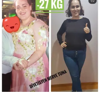 Dyt. Merve Tuna profilinde yer alan galeri fotoğrafı.