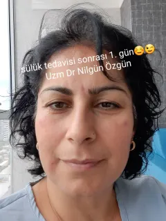 Uzm. Dr. Nilgün Özgün profilinde yer alan galeri fotoğrafı.