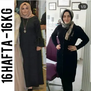 Uzm. Dyt. Dilara Turan Karayel profilinde yer alan galeri fotoğrafı.