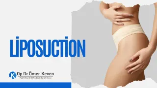 Op. Dr. Ömer Keven profilinde yer alan galeri fotoğrafı.