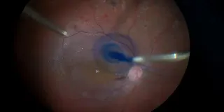 Op. Dr. Ahmet Eroğlu profilinde yer alan galeri fotoğrafı.