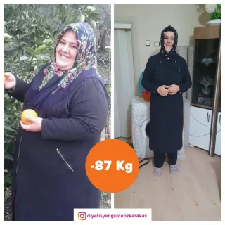 Dyt. Gülce Özdağ profilinde yer alan galeri fotoğrafı.
