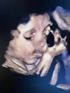 Op. Dr. Sibel Barut profilinde yer alan galeri fotoğrafı.
