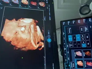 Op. Dr. İpek Demir profilinde yer alan galeri fotoğrafı.