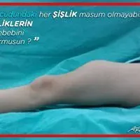 Prof. Dr. Halil Atmaca profilinde yer alan galeri fotoğrafı.