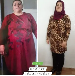 Dyt. Gül Acartürk profilinde yer alan galeri fotoğrafı.