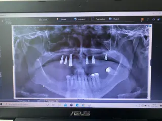 Dt. Melis Çakan profilinde yer alan galeri fotoğrafı.