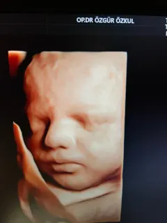 Op. Dr. Özgür Özkul profilinde yer alan galeri fotoğrafı.