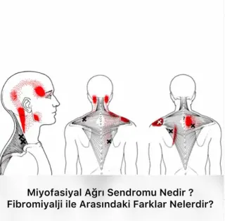 Fzt. Nur Erginsoy profilinde yer alan galeri fotoğrafı.