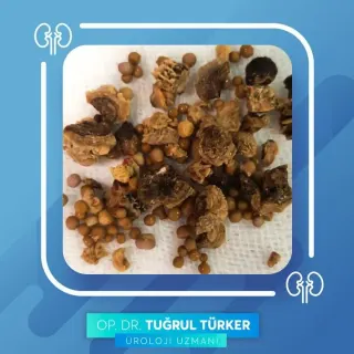 Op. Dr. Tuğrul Türker profilinde yer alan galeri fotoğrafı.