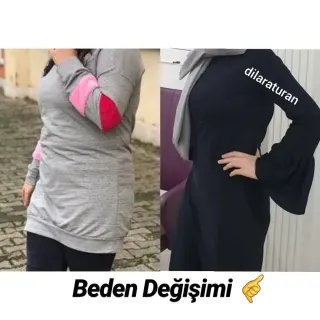 Uzm. Dyt. Dilara Turan Karayel profilinde yer alan galeri fotoğrafı.