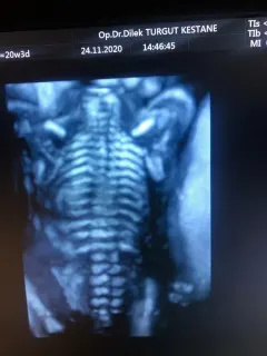 Op. Dr. Dilek Turğut Kestane profilinde yer alan galeri fotoğrafı.