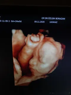 Op. Dr. Özlem Borazan profilinde yer alan galeri fotoğrafı.