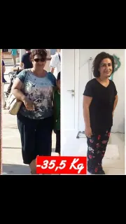 Dyt. Merve Ertem İbiş profilinde yer alan galeri fotoğrafı.
