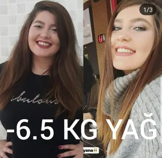 Uzm. Dyt. Dilara Turan Karayel profilinde yer alan galeri fotoğrafı.