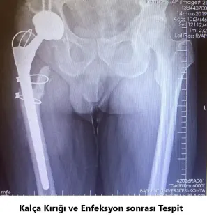 Op. Dr. Javid M. Azarabadı profilinde yer alan galeri fotoğrafı.