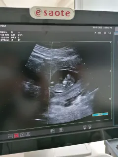 Op. Dr. Talha Ayvaz profilinde yer alan galeri fotoğrafı.