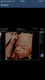 Op. Dr. Feyza Özçelik profilinde yer alan galeri fotoğrafı.