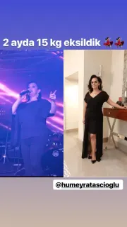 Uzm. Dyt. Asiye Kübra Dursun profilinde yer alan galeri fotoğrafı.