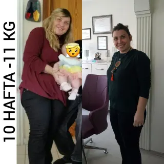 Uzm. Dyt. Dilara Turan Karayel profilinde yer alan galeri fotoğrafı.