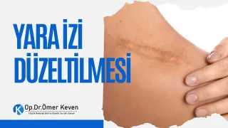 Op. Dr. Ömer Keven profilinde yer alan galeri fotoğrafı.