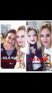 Dyt. Merve Ertem İbiş profilinde yer alan galeri fotoğrafı.